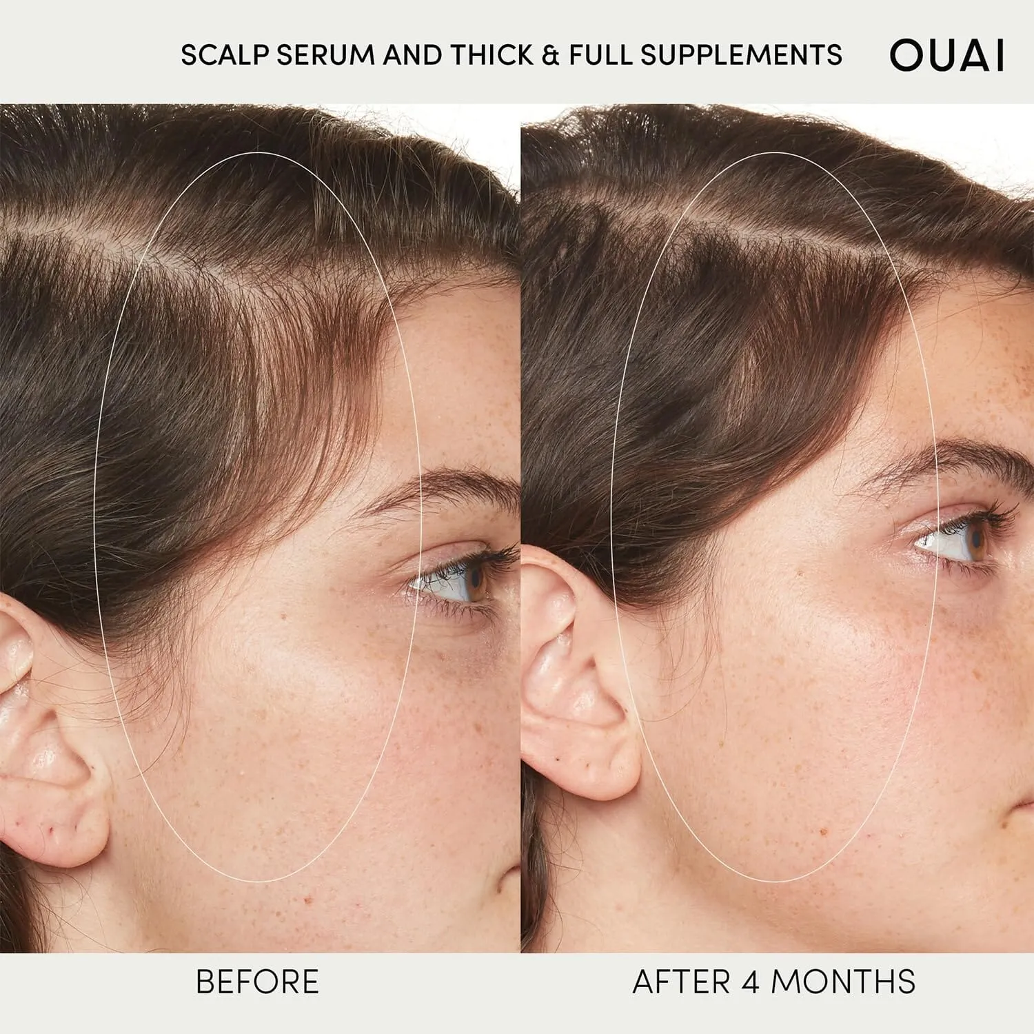 OUAI Scalp Serum - Balancing and Hydrating Serum